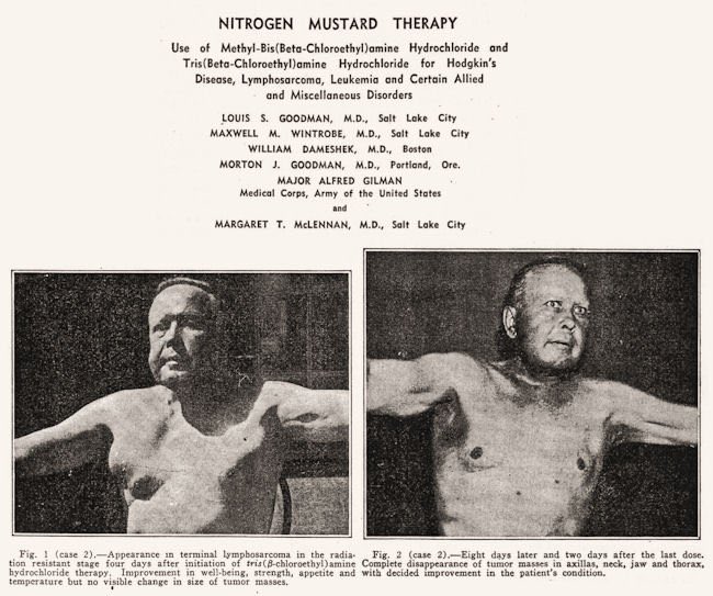 JD was a 47-year-old Polish immigrant with masses choking his neck. A month after the first dose his tumors were undetectable. They came back at day 49. Three courses, diminishing each time. He died on day 96 of bleeding from marrow suppression. The work was classified war research; Goodman and Gilman couldn’t publish until 1946. Yale 1942 nitrogen mustard archival image